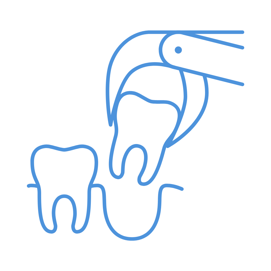Tooth Extractions